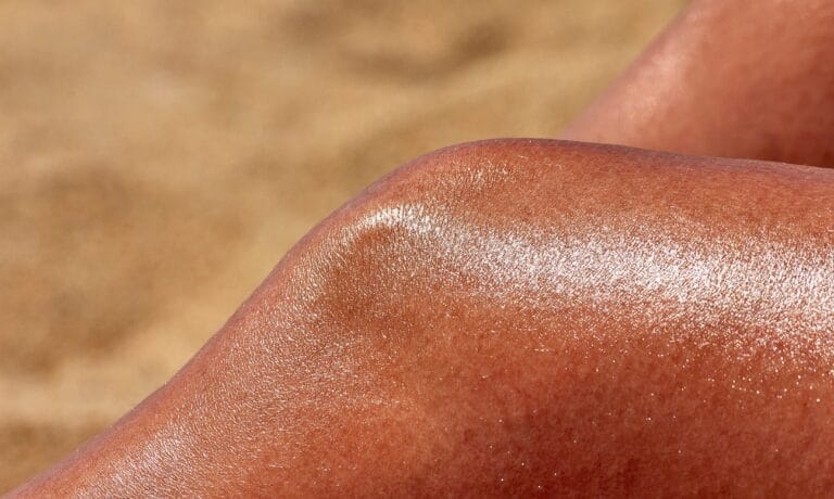 sun damage dr anjali