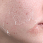Central Heating and Your Skin: Why Central Heating Causes Dry Skin (and How to Fix It)
