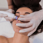 What Is a medical-grade laser facial and is it worth it?