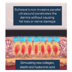 Sofwave and Ultherapy: what ultrasound lifting really does, and why clinical governance matters more than the machine